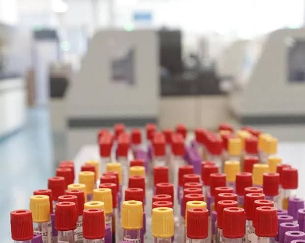 A Francoforte, i casi di malaria salgono a otto: tre decessi nell'area aeroportuale